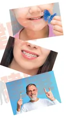 口腔正畸“做好功课”效率高
