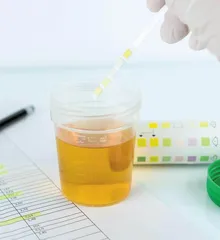 警惕引起检查结果异常的药物
