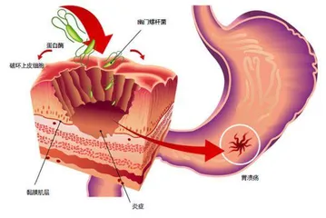 当科幻成为现实:微型机器人精准克癌9