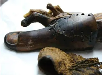 3万年前有截肢手术吗?3