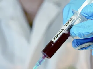 丛林中的梦魇——埃博拉病毒
