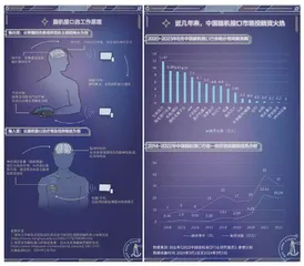 脑机接口,打开“脑世界”的大门1