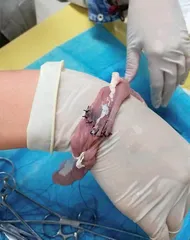 法医学:为生者权,为死者言5
