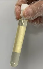 察“颜”观色识尿液
