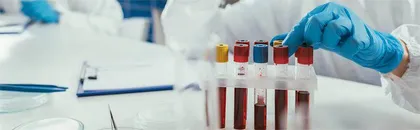  体检采血你该了解这些事