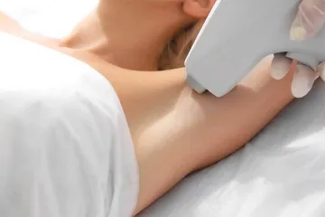 腋下的“小秘密” 副乳1