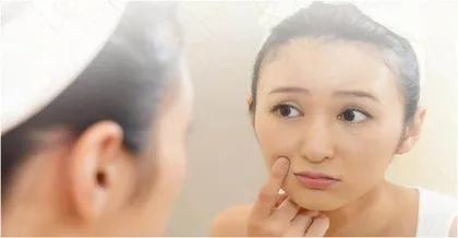 如何防治黄褐斑
