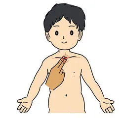 治疗呕吐小儿推拿有妙招1