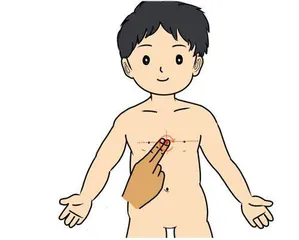 治疗呕吐小儿推拿有妙招2
