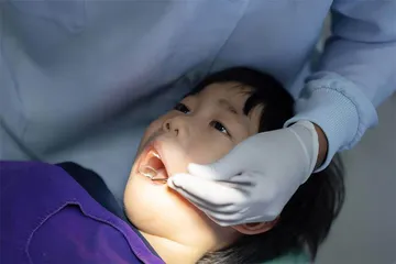 牙齿“地包天” 矫正要趁早1