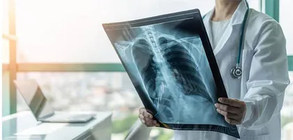 不可忽视的支原体肺炎1