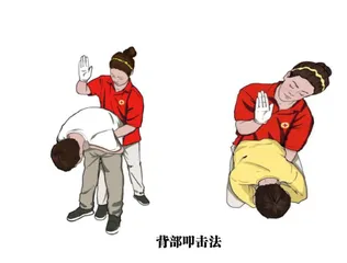 吃饭防噎 生死相关的急救知识1
