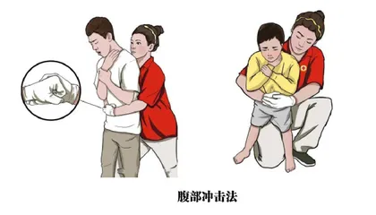 吃饭防噎 生死相关的急救知识2