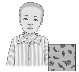 远离地中海贫血0