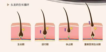 无所不知的头发2