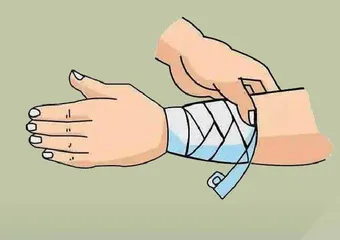 战场上的第一救生器材:止血带2