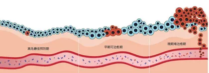 追踪血液中癌症密码的“福尔摩斯”