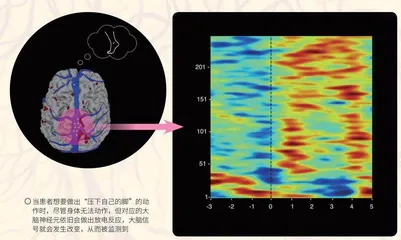 让意识发声:脑机接口技术5
