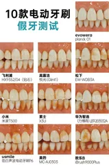 100元和1000元的电动牙刷差距大吗?7