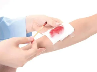 新型敷料能快速导出伤口黏液