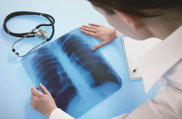 医学影像的重要力量