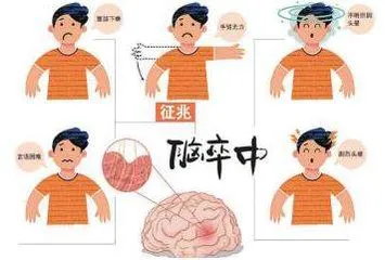 青少年脑卒中病因、诊断、治疗与预防 