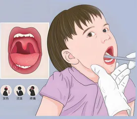 儿童口腔黏膜病家长需要了解的知识