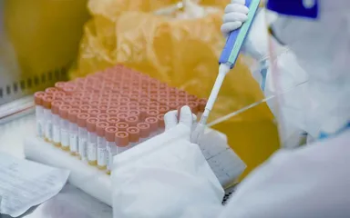 疫情防控形势严峻,我们该如何应对1