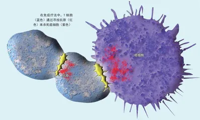 “伤口撒盐”其实有助于治疗癌症1