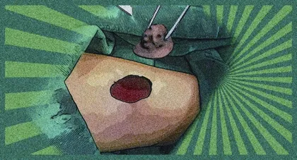 吃生鱼片蘸芥末能“杀虫”?多看绿色能保护视力?这波流言看好了!1