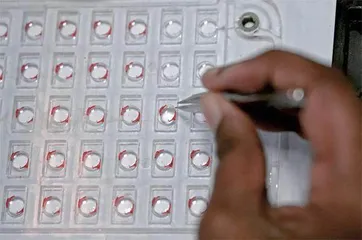 人工晶体置换:明星手术的暗面风险2