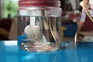 首例猪心移植患者去世,我们学到什么?1
