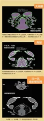 CT透蟹2