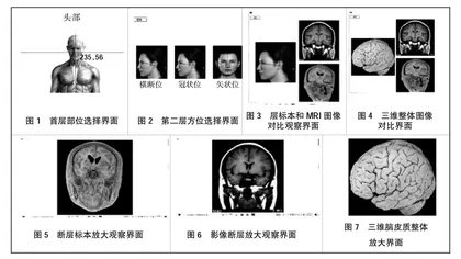 端脑皮质断层解剖辅助教学应用程序开发