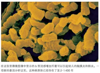 感染儿童超过1400年的致命细菌