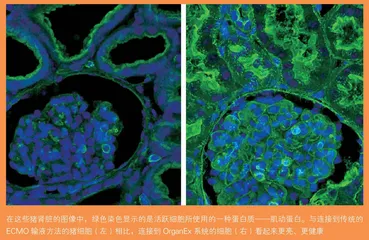 猪死亡1 小时后，人造系统恢复了细胞的生命