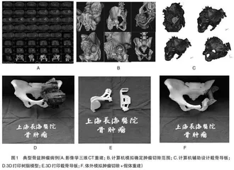 CBL结合3D打印在骨肿瘤临床教学中的运用