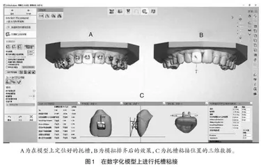 数字化虚拟托槽定位在正畸教学中的应用