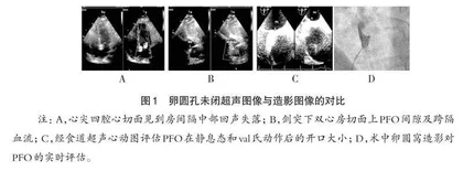 卵圆窝造影在卵圆孔未闭精准封堵临床教学中的应用