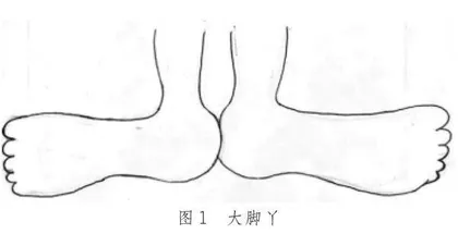 生命中的“大脚丫”