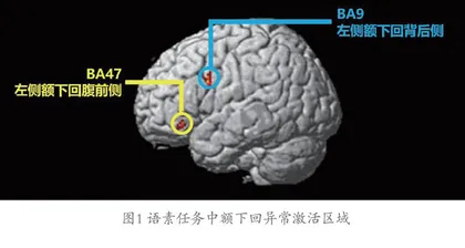 学习障碍的脑机制