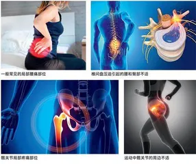 先治腰,还是先治髋?1