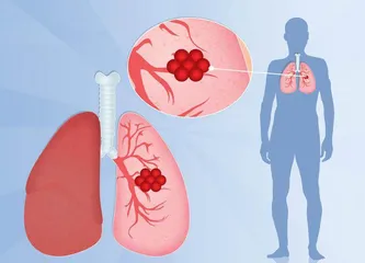 癌症泄露的密码2
