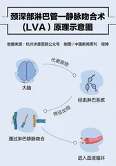 手术治疗老年痴呆,靠谱吗?2