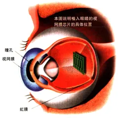 色盲眼镜与盲人芯片1