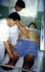 孟庆刚减肥