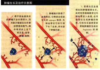 对抗癌瘤的“饥饿疗法”3