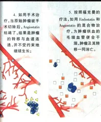 对抗癌瘤的“饥饿疗法”4