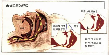 了解睡眠