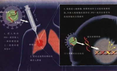 肺癌患者的福音